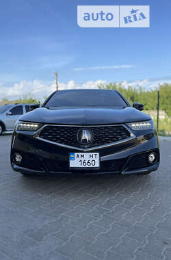 Седан Acura TLX 2018 в Житомирі