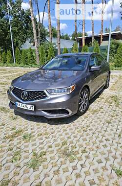 Седан Acura TLX 2017 в Харькове