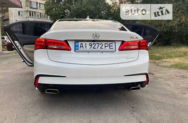 Седан Acura TLX 2017 в Киеве