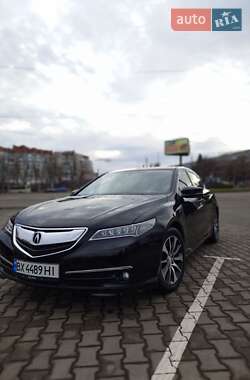 Седан Acura TLX 2015 в Хмельницькому