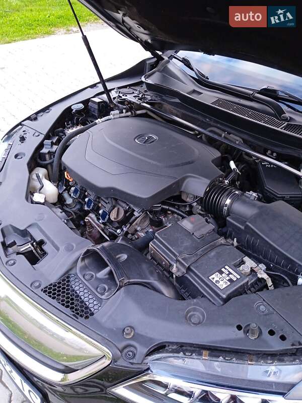 Седан Acura TLX 2015 в Калуше