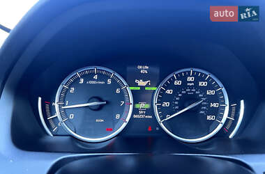 Седан Acura TLX 2017 в Киеве