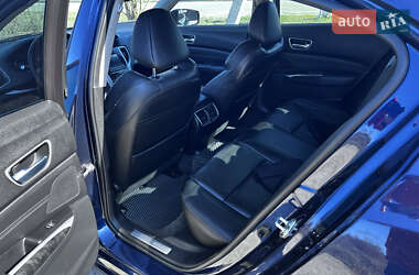 Седан Acura TLX 2017 в Киеве