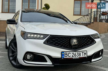 Седан Acura TLX 2018 в 