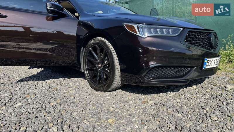 Седан Acura TLX 2017 в Хмельницком фото 2 Седан Acura TLX 2017 в Хмельницком