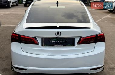 Седан Acura TLX 2018 в Києві