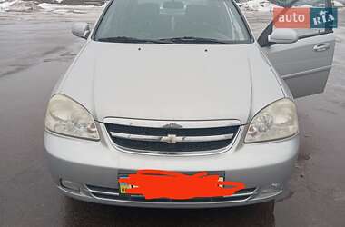 Седан Chevrolet Lacetti 2004 в Прилуках