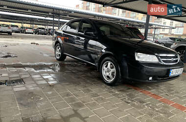 Седан Chevrolet Lacetti 2005 в Житомирі