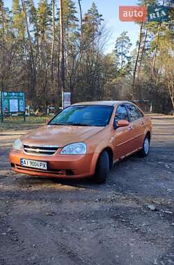 Седан Chevrolet Lacetti 2007 в Калинівці