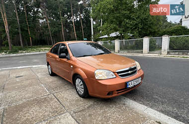 Седан Chevrolet Lacetti 2007 в Киеве