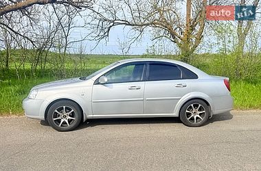 Седан Chevrolet Lacetti 2007 в Одесі