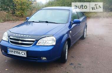 Седан Chevrolet Nubira 2005 в Житомире