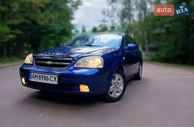 Седан Chevrolet Nubira 2005 в Житомире