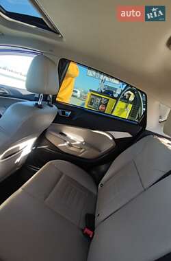 Хэтчбек Ford Fiesta 2016 в 