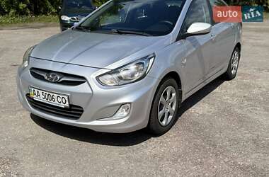 Седан Hyundai Accent 2013 в Житомирі