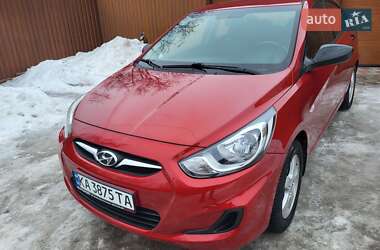 Седан Hyundai Accent 2013 в Житомире