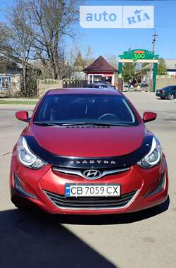 Седан Hyundai Elantra 2015 в Чернігові