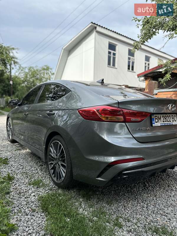 Седан Hyundai Elantra 2016 в Конотопе фото 3 Седан Hyundai Elantra 2016 в Конотопе