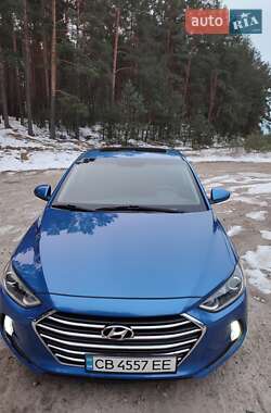 Седан Hyundai Elantra 2016 в Чернігові