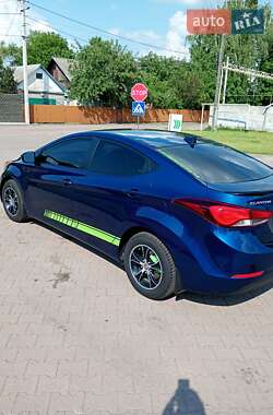 Седан Hyundai Elantra 2015 в Житомире