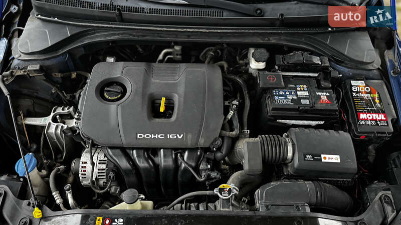 Седан Hyundai Elantra 2016 в Києві фото 3 Седан Hyundai Elantra 2016 в Києві