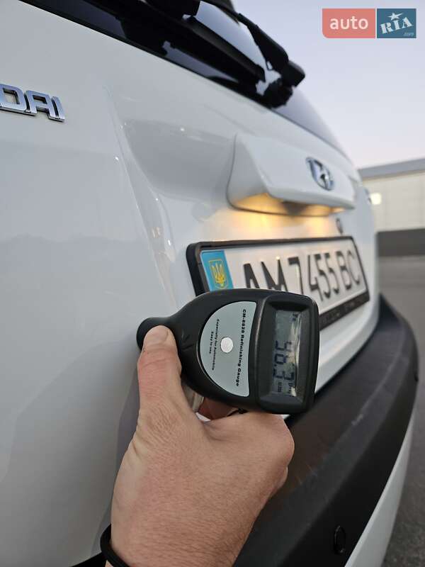 Хетчбек Hyundai Getz 2011 в Житомирі