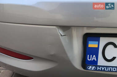 Хэтчбек Hyundai i10 2013 в 