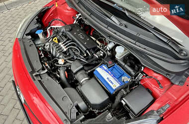 Хэтчбек Hyundai i20 2014 в 
