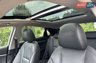 Хэтчбек Hyundai i30 2015 в 