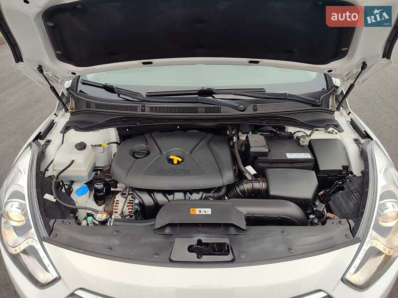 Седан Hyundai i40 2015 в Чернігові