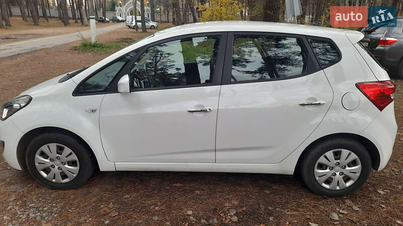 Хетчбек Hyundai ix20 2013 в Житомирі фото 11 Хетчбек Hyundai ix20 2013 в Житомирі