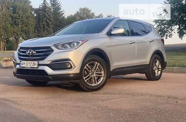 Позашляховик / Кросовер Hyundai Santa FE 2017 в Житомирі