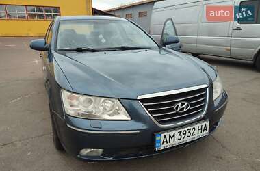 Седан Hyundai Sonata 2009 в Житомире