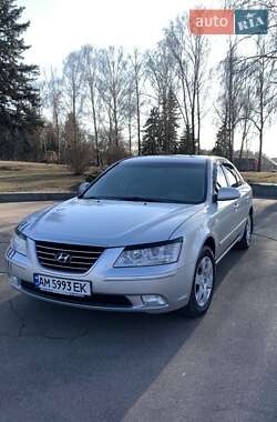 Седан Hyundai Sonata 2008 в Житомире