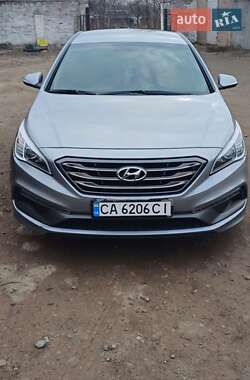 Седан Hyundai Sonata 2015 в Золотоноші