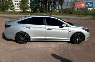 Седан Hyundai Sonata 2016 в Киеве