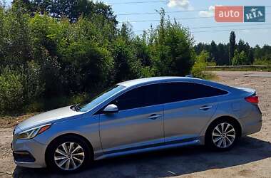 Седан Hyundai Sonata 2016 в Житомире