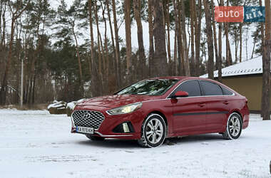 Седан Hyundai Sonata 2017 в Житомире