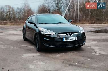 Хетчбек Hyundai Veloster 2016 в Житомирі