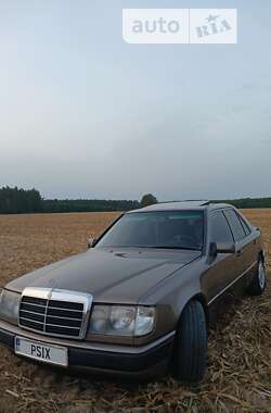 Седан Mercedes-Benz E-Class 1989 в Житомирі