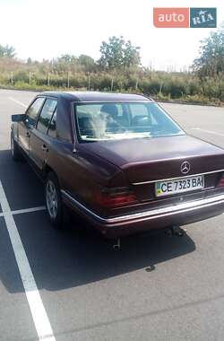 Седан Mercedes-Benz E-Class 1986 в Вінниці